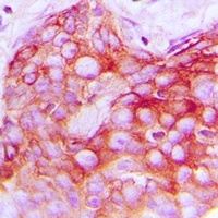 HER2 Rabbit Polyclonal Antibody