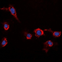 HER2 Rabbit Polyclonal Antibody