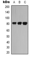 LRRC41 Rabbit Polyclonal Antibody