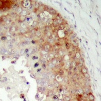 LRRC41 Rabbit Polyclonal Antibody