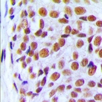 PRPF6 Antibody