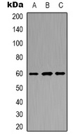 POTEB Rabbit Polyclonal Antibody