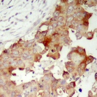 POTEB Rabbit Polyclonal Antibody