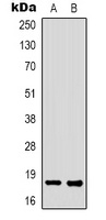 FAT10 Rabbit Polyclonal Antibody