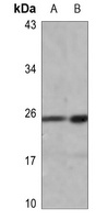 HMGB1 (Acetyl-K12) Rabbit Polyclonal Antibody