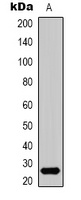 HMGB1 Rabbit Polyclonal Antibody
