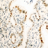 HMGB1 Rabbit Polyclonal Antibody