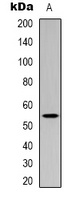 p53 (Acetyl-K382) Rabbit Polyclonal Antibody