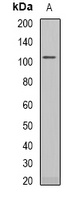 RB1 Rabbit Polyclonal Antibody