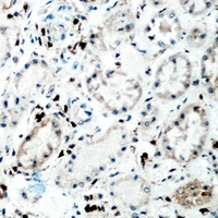 Tenascin C Antibody
