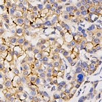 CD133 Antibody