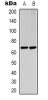 STRA8 Rabbit Polyclonal Antibody