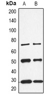 CALB1 Antibody