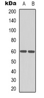 HEXA Rabbit Polyclonal Antibody