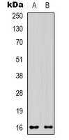 CD235a Rabbit Polyclonal Antibody