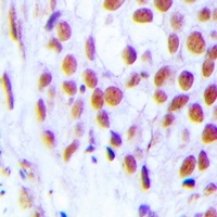 FOG2 Rabbit Polyclonal Antibody