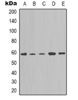 NOTCH4 Rabbit Polyclonal Antibody