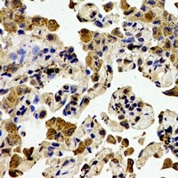 ZAP70 Rabbit Polyclonal Antibody