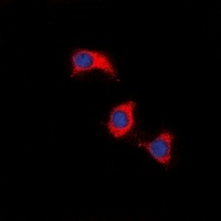 ZAP70 Rabbit Polyclonal Antibody