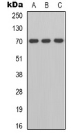 ZAP70 Rabbit Polyclonal Antibody