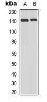 eNOS (Phospho-T494) Rabbit Polyclonal Antibody