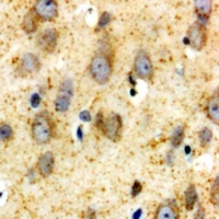 GLUR1 Rabbit Polyclonal Antibody