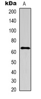 IL-16 Rabbit Polyclonal Antibody