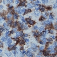IL-16 Rabbit Polyclonal Antibody