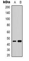 GATA5 Rabbit Polyclonal Antibody