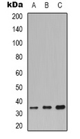CDC34 Rabbit Polyclonal Antibody