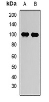 STAT5B Rabbit Polyclonal Antibody