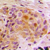 STAT5B Rabbit Polyclonal Antibody