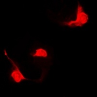 STAT5B Rabbit Polyclonal Antibody