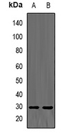 TPMT Rabbit Polyclonal Antibody