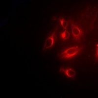 TPMT Rabbit Polyclonal Antibody