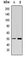 PSMD4 Rabbit Polyclonal Antibody
