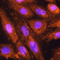 PSMD4 Rabbit Polyclonal Antibody