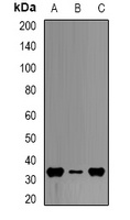 HADH Rabbit Polyclonal Antibody