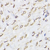 Emerin Rabbit Polyclonal Antibody