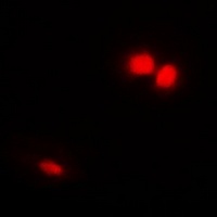 Emerin Rabbit Polyclonal Antibody
