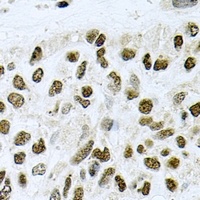 CTCF Rabbit Polyclonal Antibody