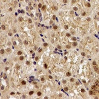 EGLN1 Rabbit Polyclonal Antibody