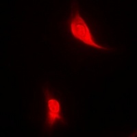 EGLN1 Rabbit Polyclonal Antibody