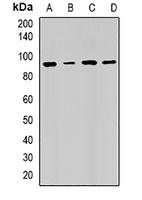 RRM1 Rabbit Polyclonal Antibody