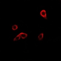 RRM1 Rabbit Polyclonal Antibody