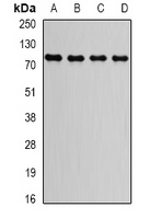 GGA2 Rabbit Polyclonal Antibody