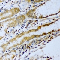 ERG Rabbit Polyclonal Antibody