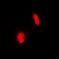 ERG Rabbit Polyclonal Antibody