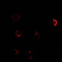 CBS Rabbit Polyclonal Antibody