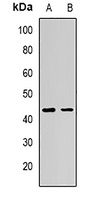 AdipoR1 Rabbit Polyclonal Antibody